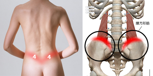 腰を反ると痛い時原因となる筋肉