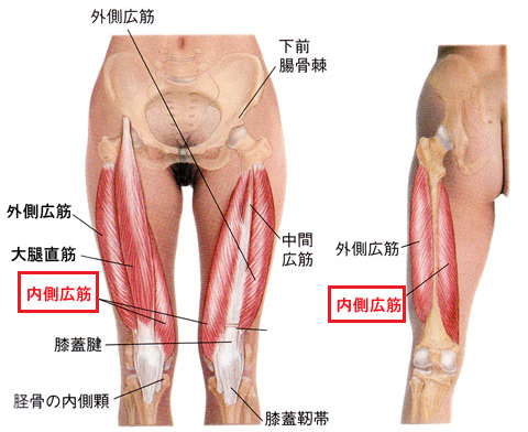 膝の内側が痛い原因の内側広筋