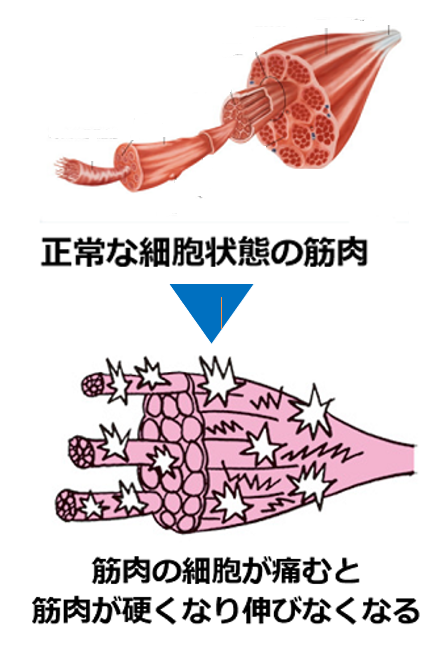 活性酸素によって筋肉が錆びるイメージ