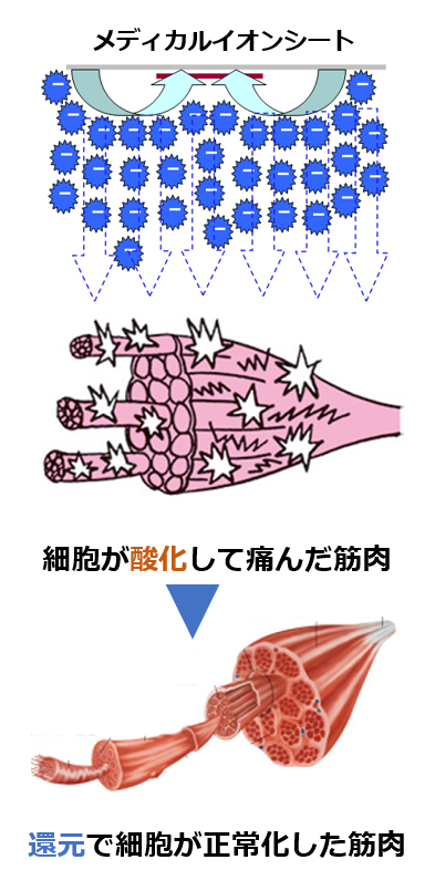 筋肉に大量のイオンを供給して痛みを改善するイメージ