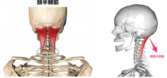 ムチウチの後遺症の原因になる頭半棘筋解説